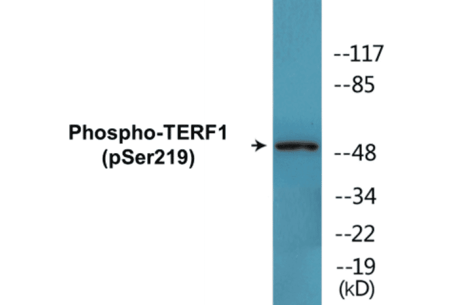 Western Blot - TERF1 (phospho Ser219) Cell Based ELISA Kit (CBP1482) - Antibodies.com