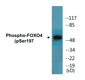 Western Blot - FOXO4 (phospho Ser197) Cell Based ELISA Kit (CBP1559) - Antibodies.com