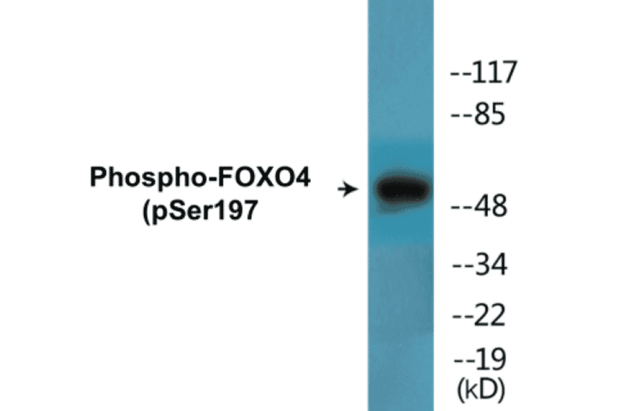 Western Blot - FOXO4 (phospho Ser197) Cell Based ELISA Kit (CBP1559) - Antibodies.com