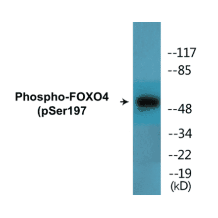 Western Blot - FOXO4 (phospho Ser197) Cell Based ELISA Kit (CBP1559) - Antibodies.com