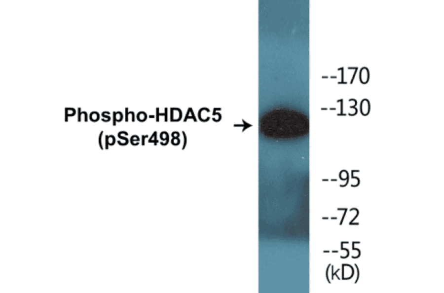 Western Blot - HDAC5 (phospho Ser498) Cell Based ELISA Kit (CBP1570) - Antibodies.com