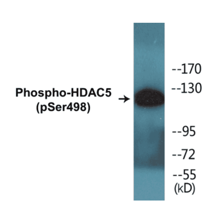 Western Blot - HDAC5 (phospho Ser498) Cell Based ELISA Kit (CBP1570) - Antibodies.com