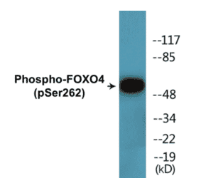 Western Blot - FOXO4 (phospho Ser262) Cell Based ELISA Kit (CBP1722) - Antibodies.com