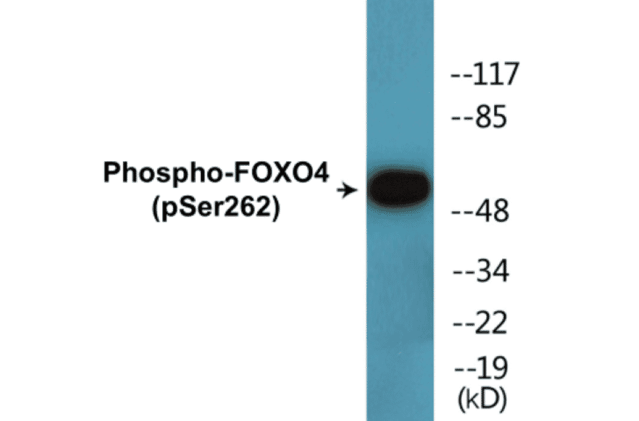 Western Blot - FOXO4 (phospho Ser262) Cell Based ELISA Kit (CBP1722) - Antibodies.com