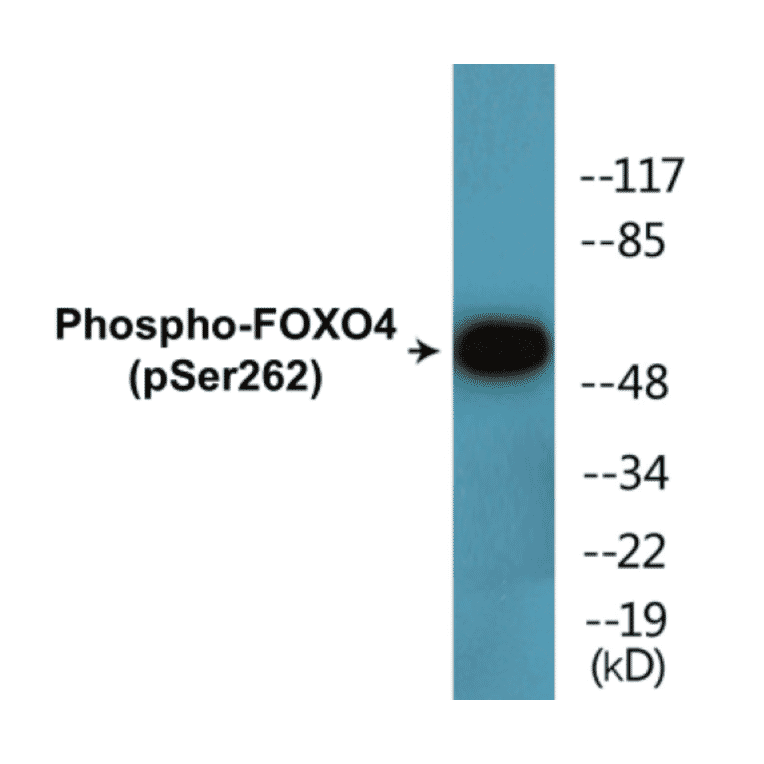 Western Blot - FOXO4 (phospho Ser262) Cell Based ELISA Kit (CBP1722) - Antibodies.com