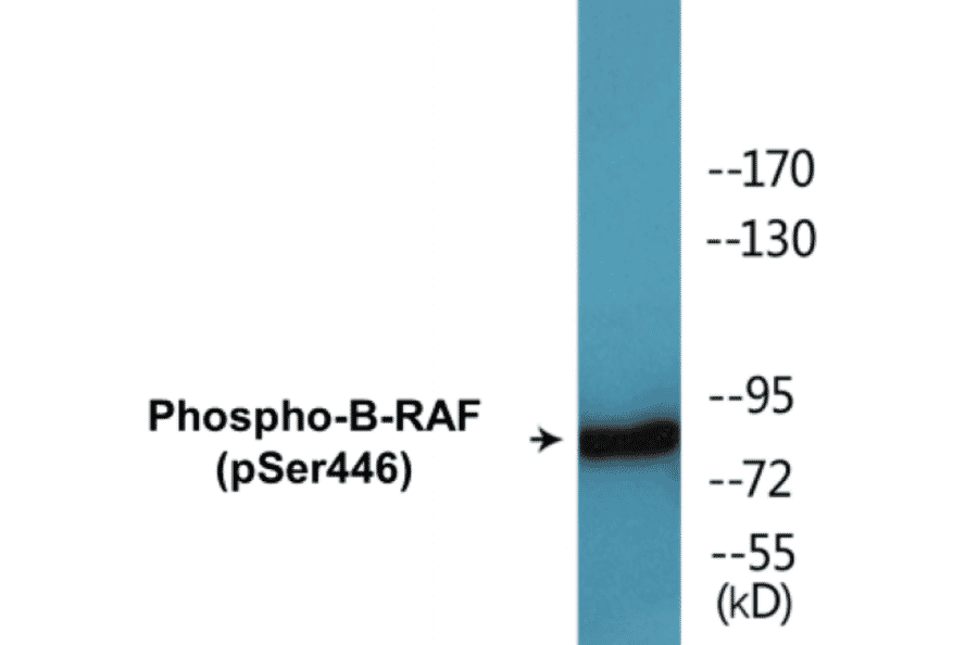 Western Blot - B-RAF (phospho Ser446) Cell Based ELISA Kit (CBP1739) - Antibodies.com