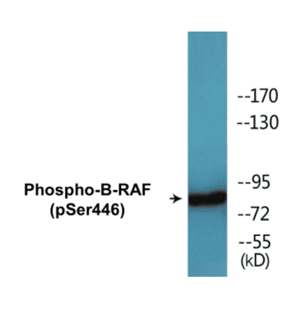 Western Blot - B-RAF (phospho Ser446) Cell Based ELISA Kit (CBP1739) - Antibodies.com