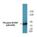Western Blot - B-RAF (phospho Ser446) Cell Based ELISA Kit (CBP1739) - Antibodies.com