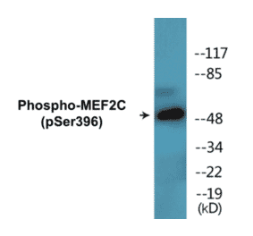 Western Blot - MEF2C (phospho Ser396) Cell Based ELISA Kit (CBP1827) - Antibodies.com