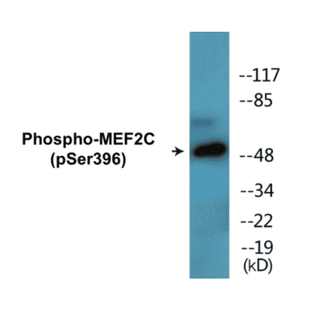 Western Blot - MEF2C (phospho Ser396) Cell Based ELISA Kit (CBP1827) - Antibodies.com