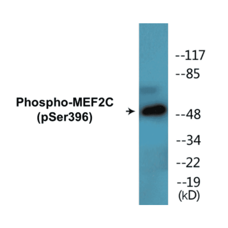 Western Blot - MEF2C (phospho Ser396) Cell Based ELISA Kit (CBP1827) - Antibodies.com