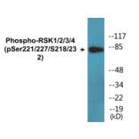Western Blot - RSK1 + 2 + 3 + 4 (phospho Ser221 + Ser227 + Ser218 + Ser232) Cell Based ELISA Kit (CBP1772) - Antibodies.com
