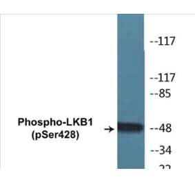 Western Blot - LKB1 (phospho Ser428) Cell Based ELISA Kit (CBP1255) - Antibodies.com