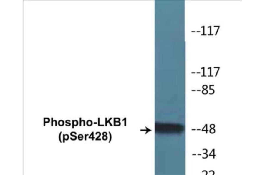 Western Blot - LKB1 (phospho Ser428) Cell Based ELISA Kit (CBP1255) - Antibodies.com