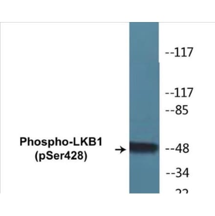 Western Blot - LKB1 (phospho Ser428) Cell Based ELISA Kit (CBP1255) - Antibodies.com