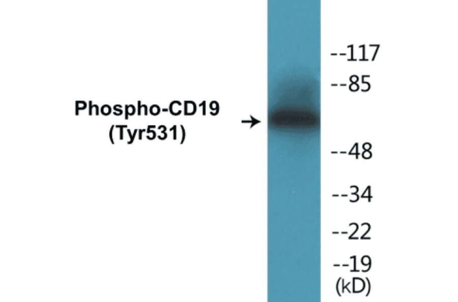Western Blot - CD19 (phospho Tyr531) Cell Based ELISA Kit (CBP1104) - Antibodies.com