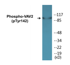 Western Blot - VAV2 (phospho Tyr142) Cell Based ELISA Kit (CBP1483) - Antibodies.com