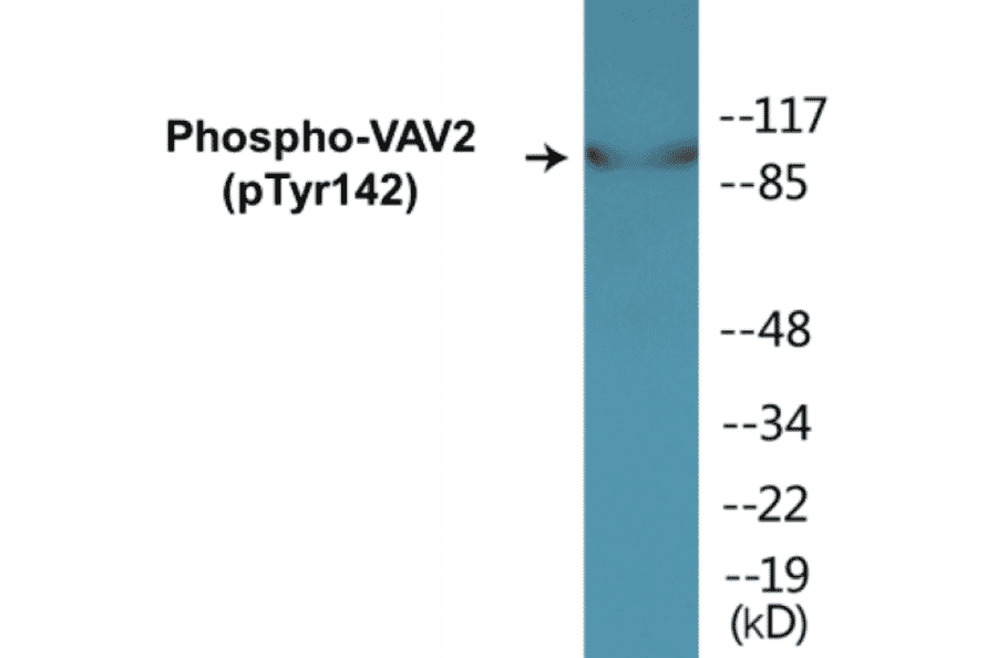 Western Blot - VAV2 (phospho Tyr142) Cell Based ELISA Kit (CBP1483) - Antibodies.com