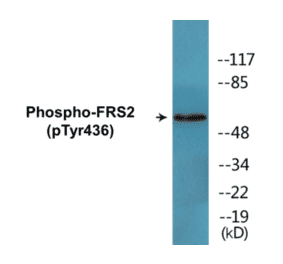 Western Blot - FRS2 (phospho Tyr436) Cell Based ELISA Kit (CBP1794) - Antibodies.com