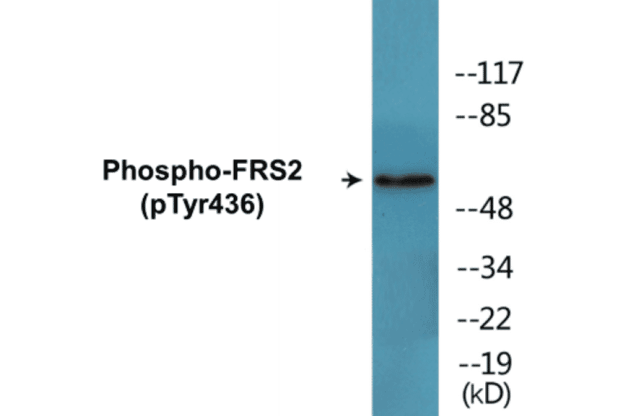 Western Blot - FRS2 (phospho Tyr436) Cell Based ELISA Kit (CBP1794) - Antibodies.com