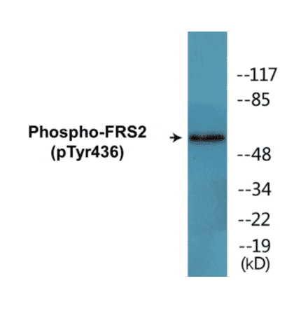 Western Blot - FRS2 (phospho Tyr436) Cell Based ELISA Kit (CBP1794) - Antibodies.com