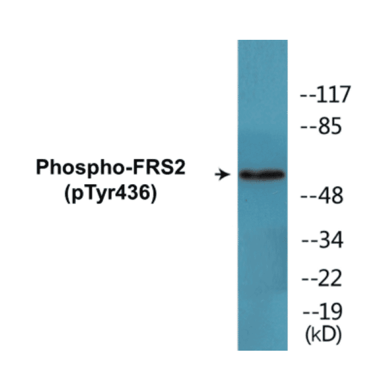 Western Blot - FRS2 (phospho Tyr436) Cell Based ELISA Kit (CBP1794) - Antibodies.com