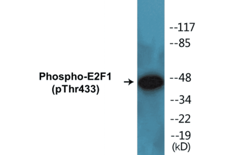 Western Blot - E2F1 (phospho Thr433) Cell Based ELISA Kit (CBP1113) - Antibodies.com