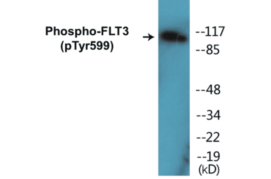 Western Blot - FLT3 (phospho Tyr599) Cell Based ELISA Kit (CBP1157) - Antibodies.com