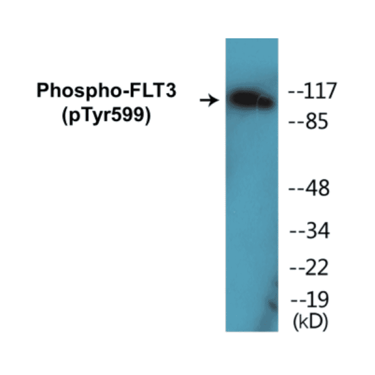 Western Blot - FLT3 (phospho Tyr599) Cell Based ELISA Kit (CBP1157) - Antibodies.com