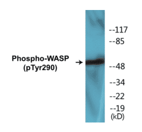 Western Blot - WASP (phospho Tyr290) Cell Based ELISA Kit (CBP1231) - Antibodies.com