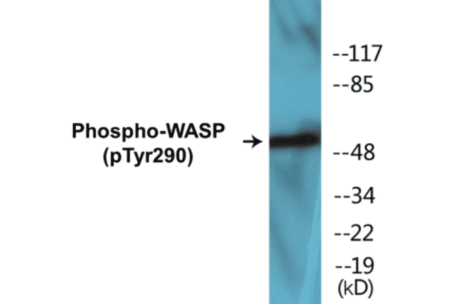 Western Blot - WASP (phospho Tyr290) Cell Based ELISA Kit (CBP1231) - Antibodies.com