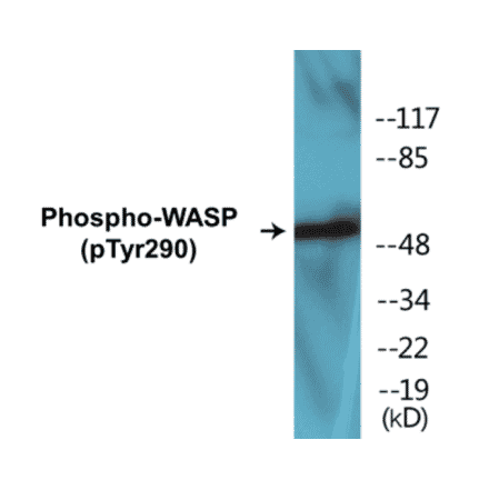 Western Blot - WASP (phospho Tyr290) Cell Based ELISA Kit (CBP1231) - Antibodies.com