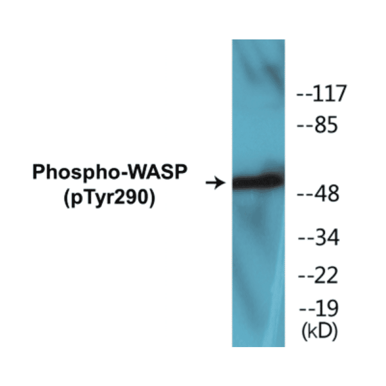 Western Blot - WASP (phospho Tyr290) Cell Based ELISA Kit (CBP1231) - Antibodies.com