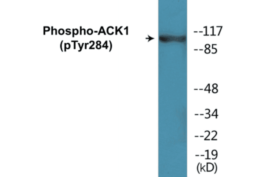 Western Blot - ACK1 (phospho Tyr284) Cell Based ELISA Kit (CBP1236) - Antibodies.com
