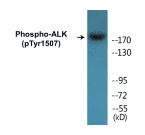 Western Blot - ALK (phospho Tyr1507) Cell Based ELISA Kit (CBP1241) - Antibodies.com