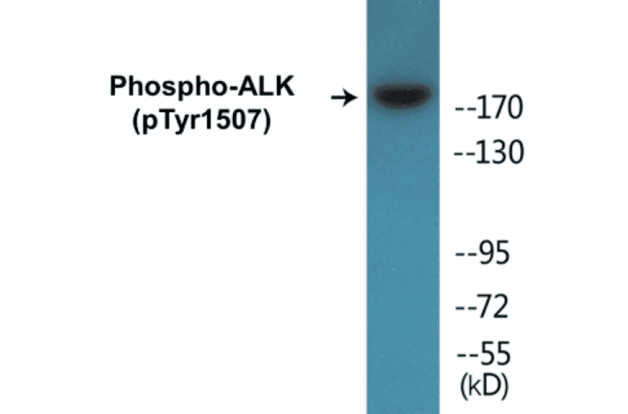 Western Blot - ALK (phospho Tyr1507) Cell Based ELISA Kit (CBP1241) - Antibodies.com