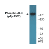 Western Blot - ALK (phospho Tyr1507) Cell Based ELISA Kit (CBP1241) - Antibodies.com