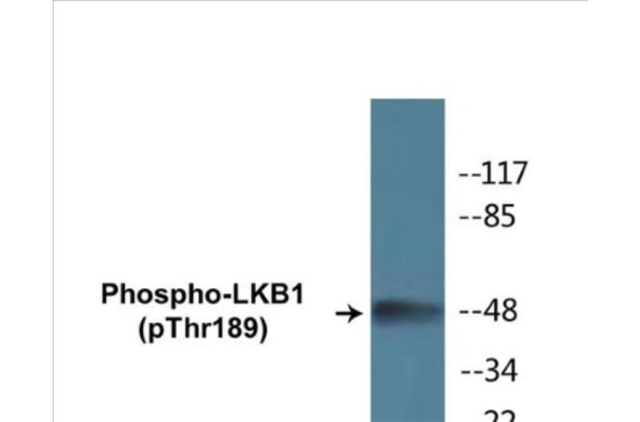 Western Blot - LKB1 (phospho Thr189) Cell Based ELISA Kit (CBP1256) - Antibodies.com