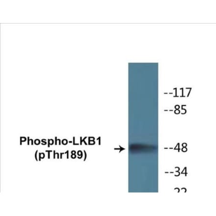 Western Blot - LKB1 (phospho Thr189) Cell Based ELISA Kit (CBP1256) - Antibodies.com