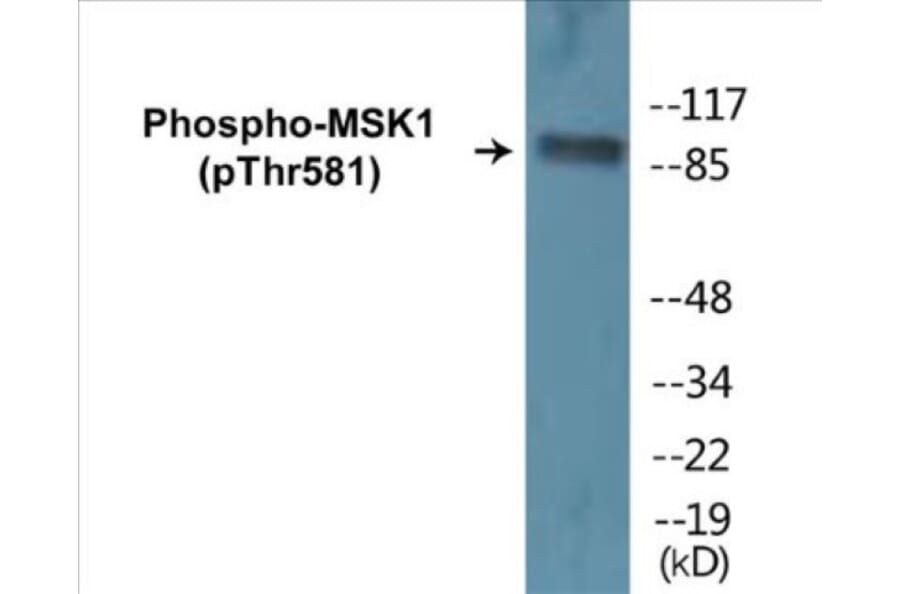 Western Blot - MSK1 (phospho Thr581) Cell Based ELISA Kit (CBP1261) - Antibodies.com