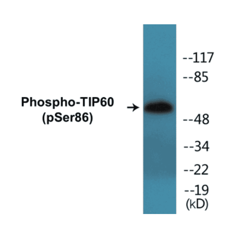 Western Blot - TIP60 (phospho Ser86) Cell Based ELISA Kit (CBP1316) - Antibodies.com