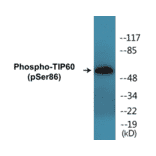 Western Blot - TIP60 (phospho Ser86) Cell Based ELISA Kit (CBP1316) - Antibodies.com
