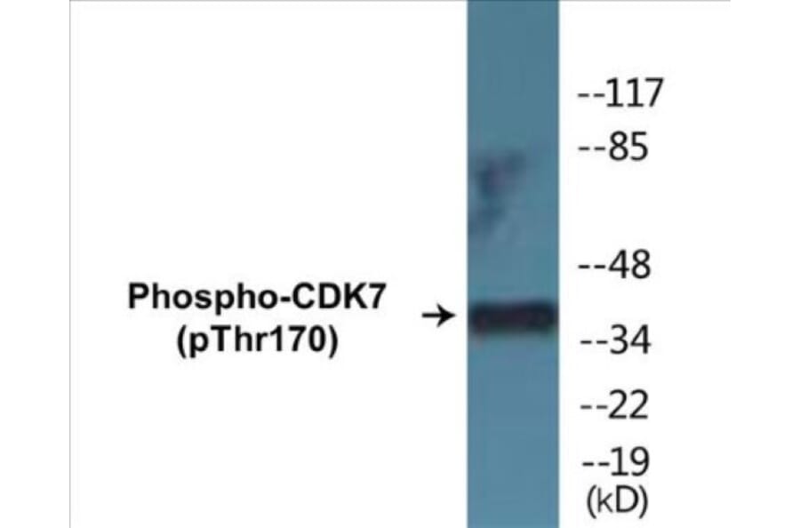 Western Blot - CDK7 (phospho Thr170) Cell Based ELISA Kit (CBP1344) - Antibodies.com