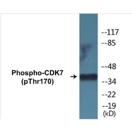 Western Blot - CDK7 (phospho Thr170) Cell Based ELISA Kit (CBP1344) - Antibodies.com
