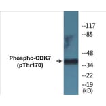Western Blot - CDK7 (phospho Thr170) Cell Based ELISA Kit (CBP1344) - Antibodies.com