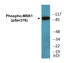 Western Blot - MSK1 (phospho Ser376) Cell Based ELISA Kit (CBP1619) - Antibodies.com