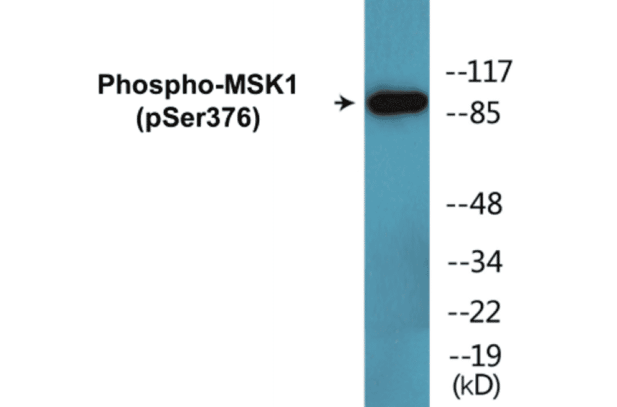 Western Blot - MSK1 (phospho Ser376) Cell Based ELISA Kit (CBP1619) - Antibodies.com