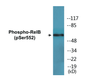 Western Blot - RelB (phospho Ser552) Cell Based ELISA Kit (CBP1669) - Antibodies.com
