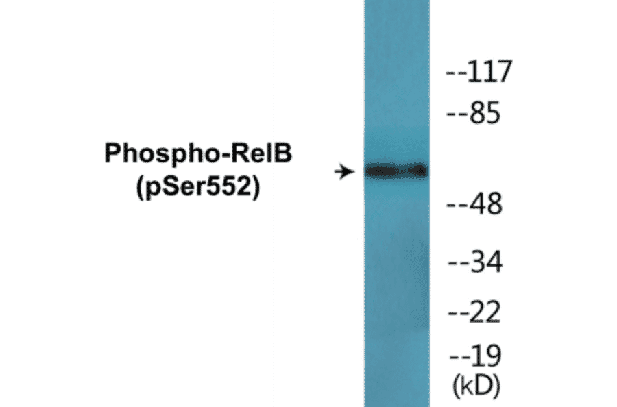 Western Blot - RelB (phospho Ser552) Cell Based ELISA Kit (CBP1669) - Antibodies.com