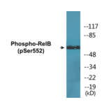 Western Blot - RelB (phospho Ser552) Cell Based ELISA Kit (CBP1669) - Antibodies.com